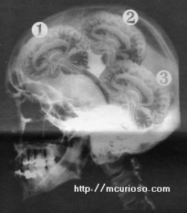 la mujer con tres cerebros la mujer con tres cerebros